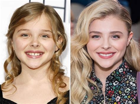 chloe grace moretz before after